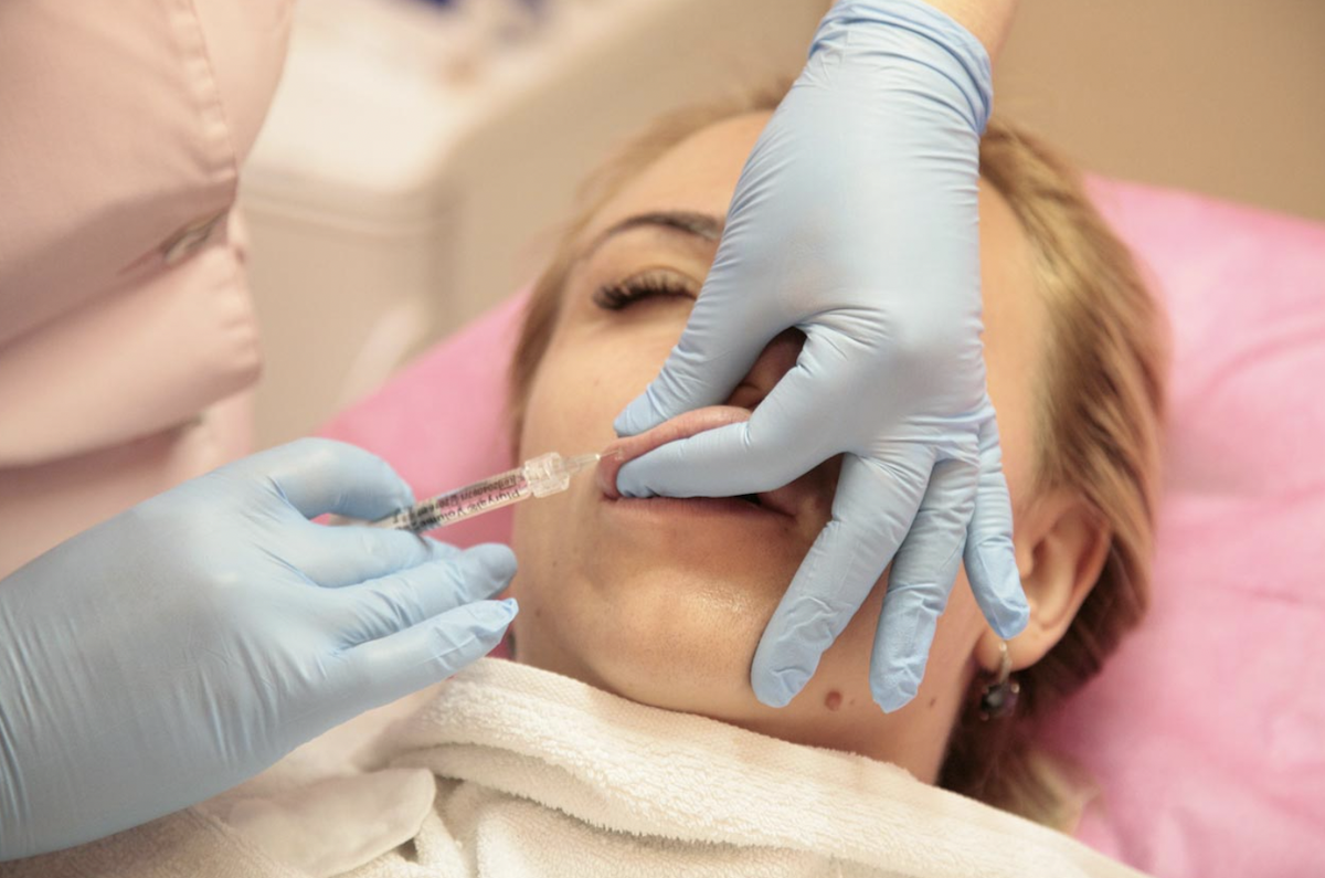 Affordable Aesthetics Comparing Lip Filler Costs In Chicago FCT