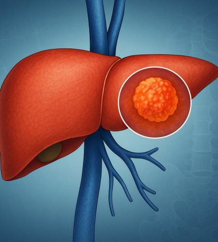Jeff Geschwind: A Leading Voice on Understanding Liver Cancer